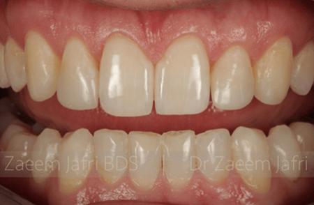 After - innovadent Dental