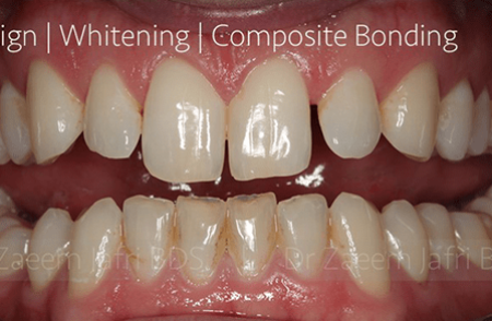 Before - innovadent Dental
