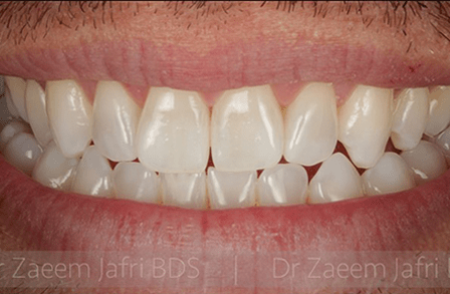 After - innovadent Dental