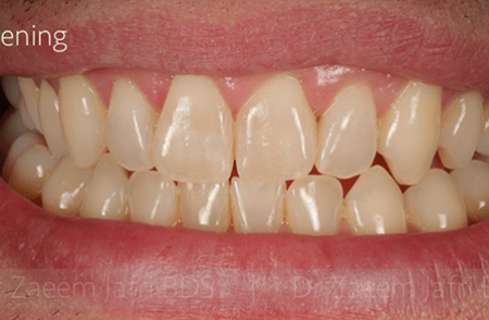 Before - innovadent Dental
