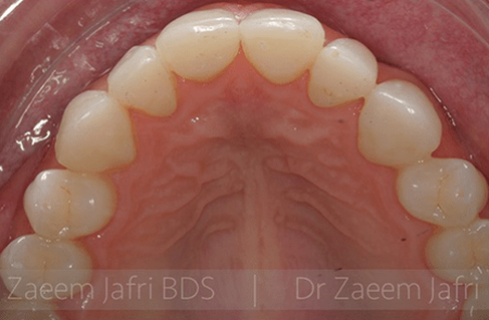 After - Innovadent Dental