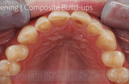 Before - Innovadent Dental