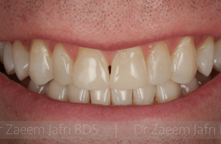 After - Innovadent Dental