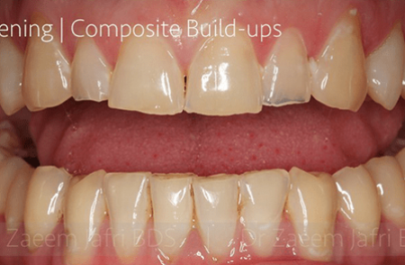 Before - Innovadent Dental