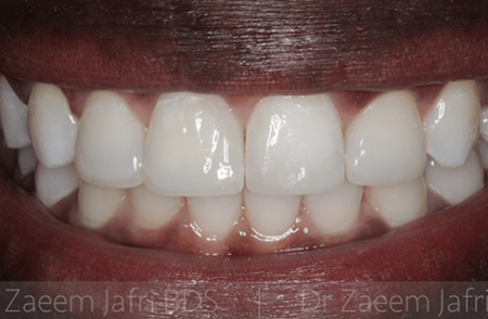 After - Innovadent Dental