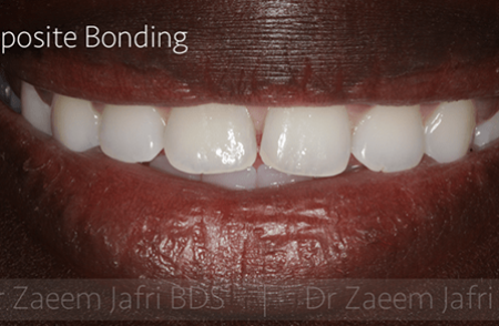 Before - Innovadent Dental