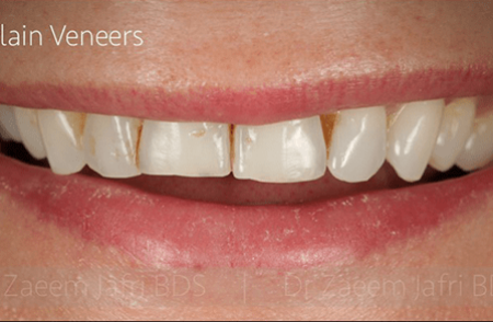 Before - Innovadent Dental