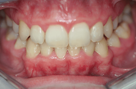 After - innovadent Dental