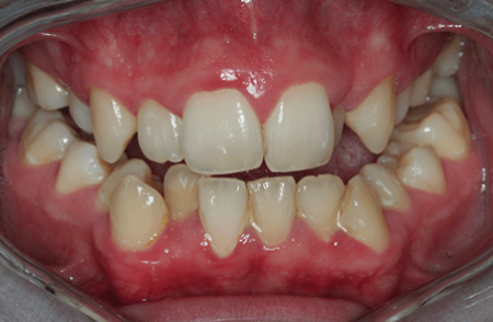 Before - innovadent Dental