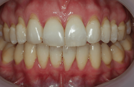After - Innovadent Dental