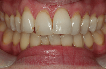 Before - Innovadent Dental