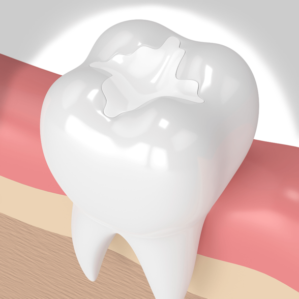 Treatment - platinumorthodontics dental