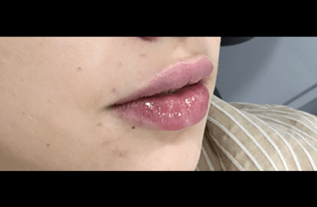 After - innovadent Dental