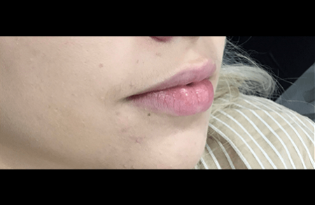 Before - innovadent Dental
