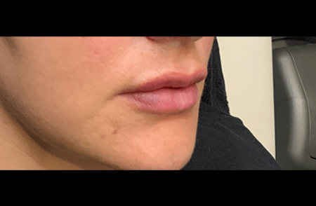 After - innovadent Dental
