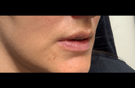 Before - innovadent Dental