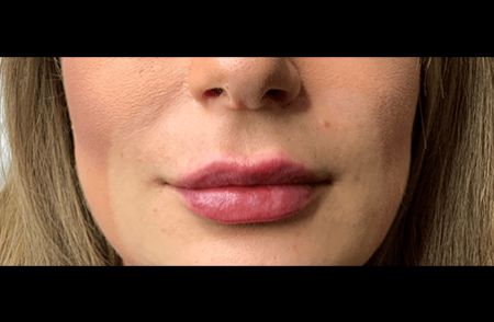 After - innovadent Dental