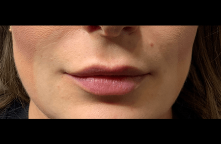 Before - innovadent Dental