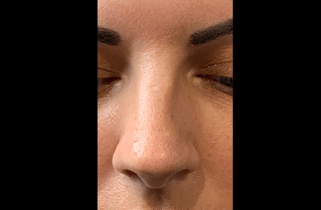 Before - innovadent Dental