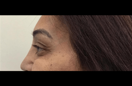 After - Innovadent Dental