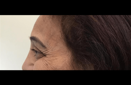 Before - Innovadent Dental
