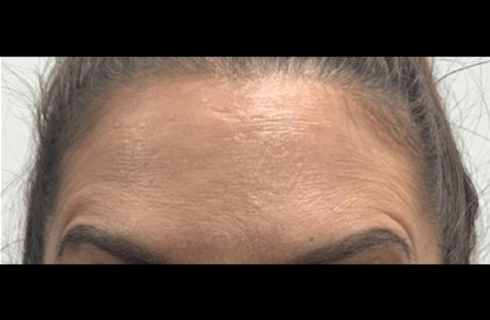 After - innovadent Dental