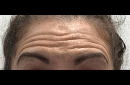 Before - innovadent Dental