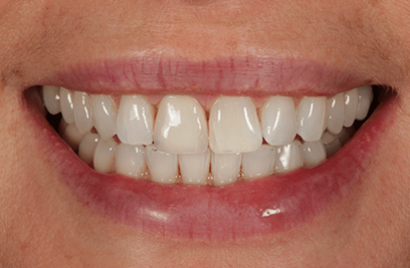 After - innovadent Dental
