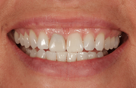 Before - innovadent Dental