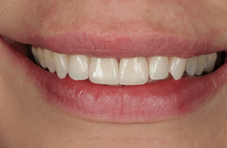 After - innovadent Dental