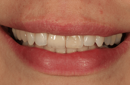 Before - innovadent Dental