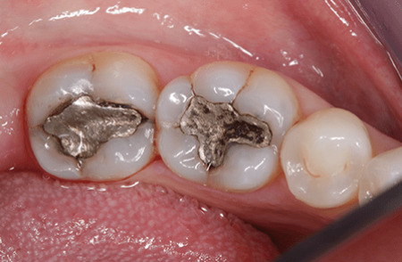 Before - innovadent Dental