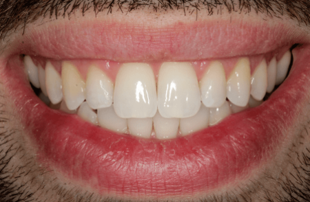 After - innovadent Dental