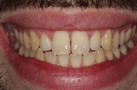Before - innovadent Dental