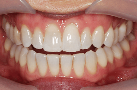 After - innovadent Dental