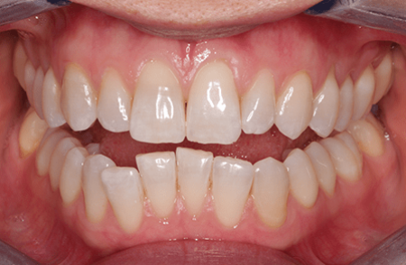 Before - innovadent Dental