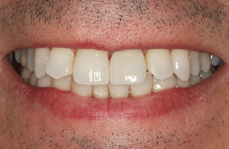 After - innovadent Dental