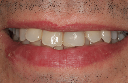 Before - innovadent Dental