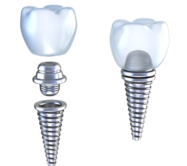 thumb- innovadent dental