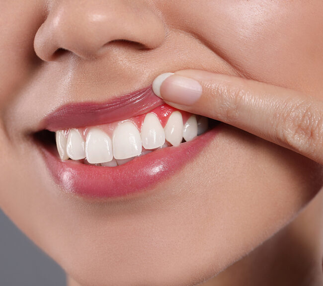 thumb-innovadent dental