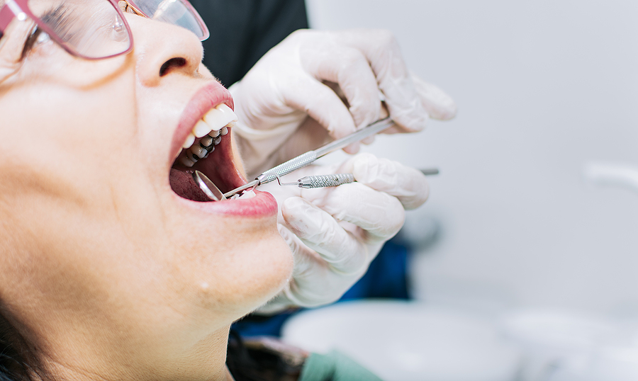 Hygienist checking patient's mouth, Close up of patient checked by dentist, close up of Hygienist's hands. 