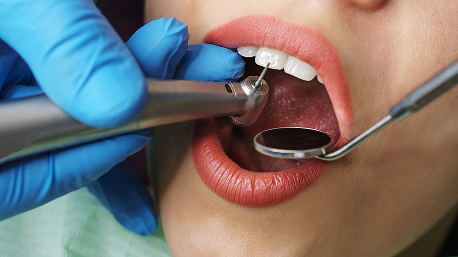 Hygienist treats woman's teeth. White teeth. Hygienist hands with medical instruments. Close-up. 