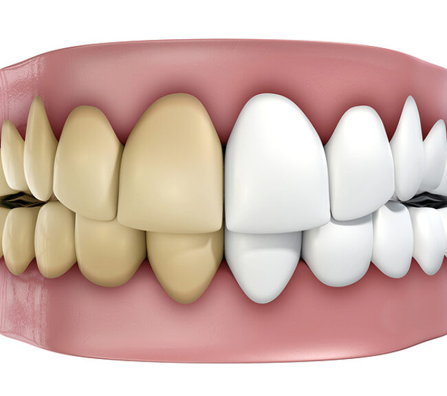 thumb-innovadent dental