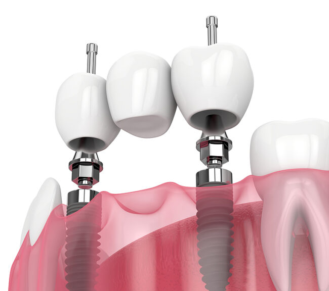 thumb-innovadent dental