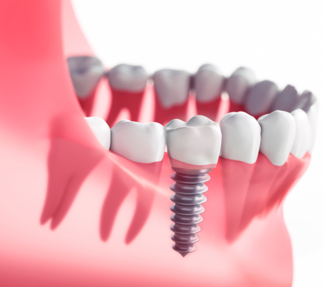 thumb- innovadent dental
