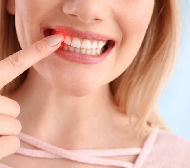 thumb-innovadent dental