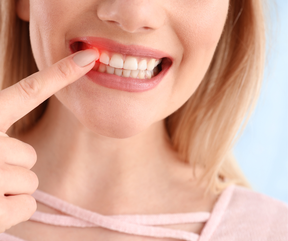 How To Prevent Bleeding Gums Innovadent Dental Clinic Dentist in